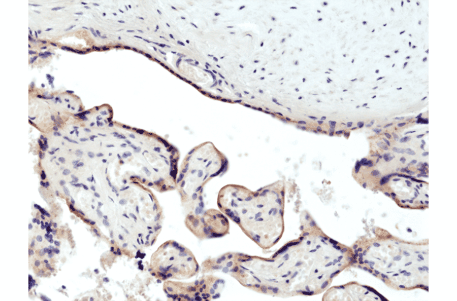 Immunohistochemistry - Anti-CD71 Antibody [RM384] (A121366) - Antibodies.com