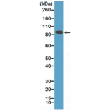 Western Blot - Anti-CD71 Antibody [RM384] (A121366) - Antibodies.com