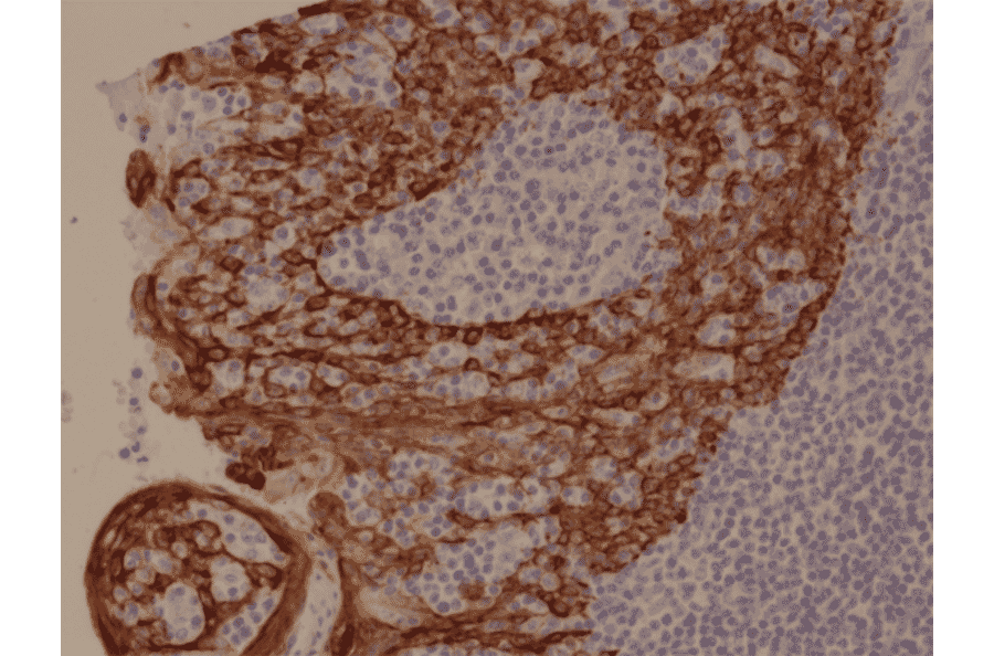 Immunohistochemistry - Anti-Cytokeratin 5 + 6 Antibody [RM341] (A121367) - Antibodies.com