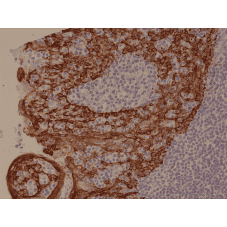 Immunohistochemistry - Anti-Cytokeratin 5 + 6 Antibody [RM341] (A121367) - Antibodies.com