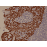 Immunohistochemistry - Anti-Cytokeratin 5 + 6 Antibody [RM341] (A121367) - Antibodies.com