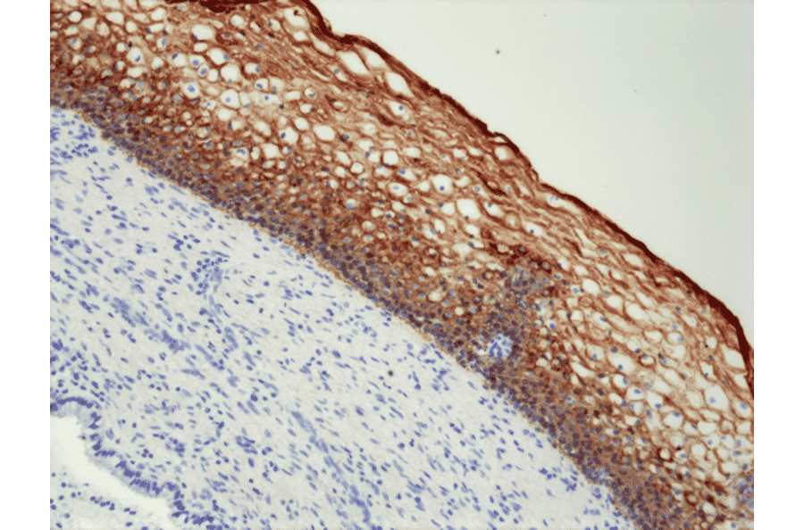 Immunohistochemistry - Anti-Cytokeratin 5 + 6 Antibody [RM341] (A121207) - Antibodies.com