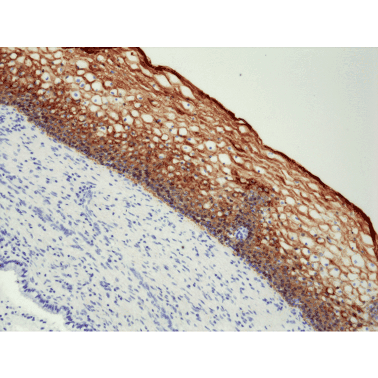 Immunohistochemistry - Anti-Cytokeratin 5 + 6 Antibody [RM341] (A121207) - Antibodies.com