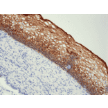 Immunohistochemistry - Anti-Cytokeratin 5 + 6 Antibody [RM341] (A121207) - Antibodies.com