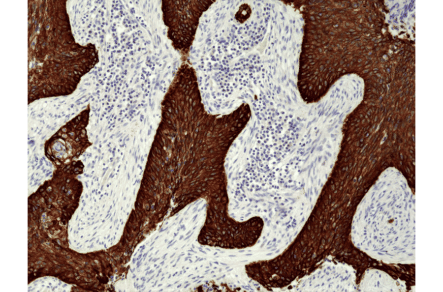 Immunohistochemistry - Anti-Cytokeratin 5 + 6 Antibody [RM341] (A121367) - Antibodies.com