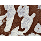 Immunohistochemistry - Anti-Cytokeratin 5 + 6 Antibody [RM341] (A121367) - Antibodies.com