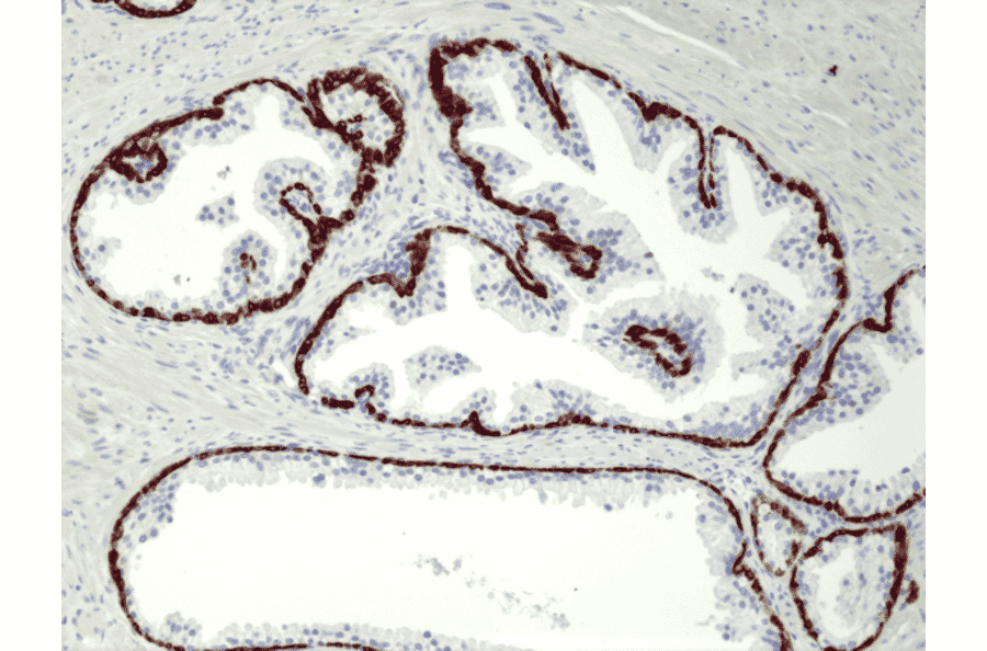 Immunohistochemistry - Anti-Cytokeratin 5 + 6 Antibody [RM341] (A121367) - Antibodies.com