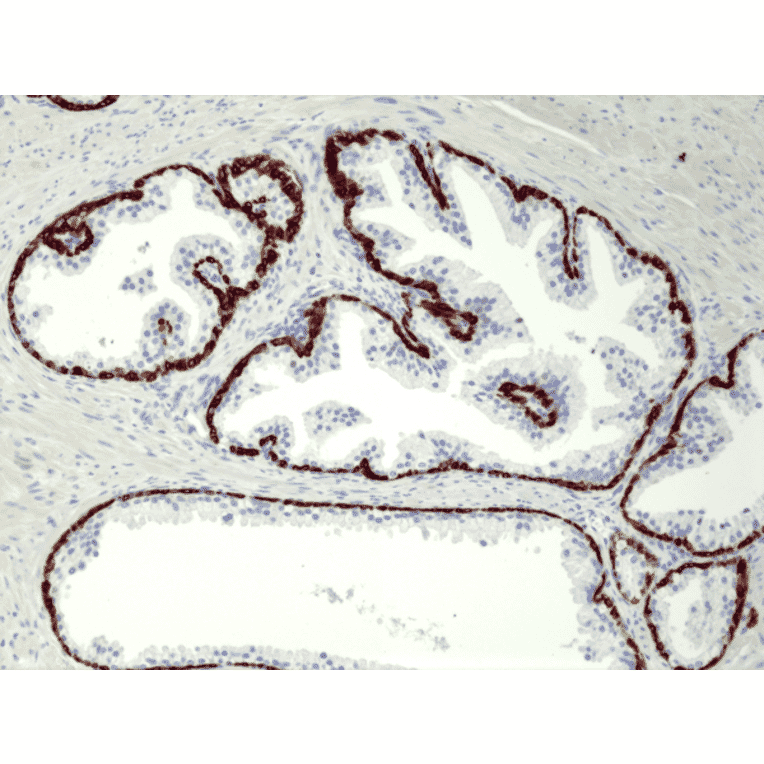 Immunohistochemistry - Anti-Cytokeratin 5 + 6 Antibody [RM341] (A121367) - Antibodies.com