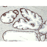 Immunohistochemistry - Anti-Cytokeratin 5 + 6 Antibody [RM341] (A121367) - Antibodies.com