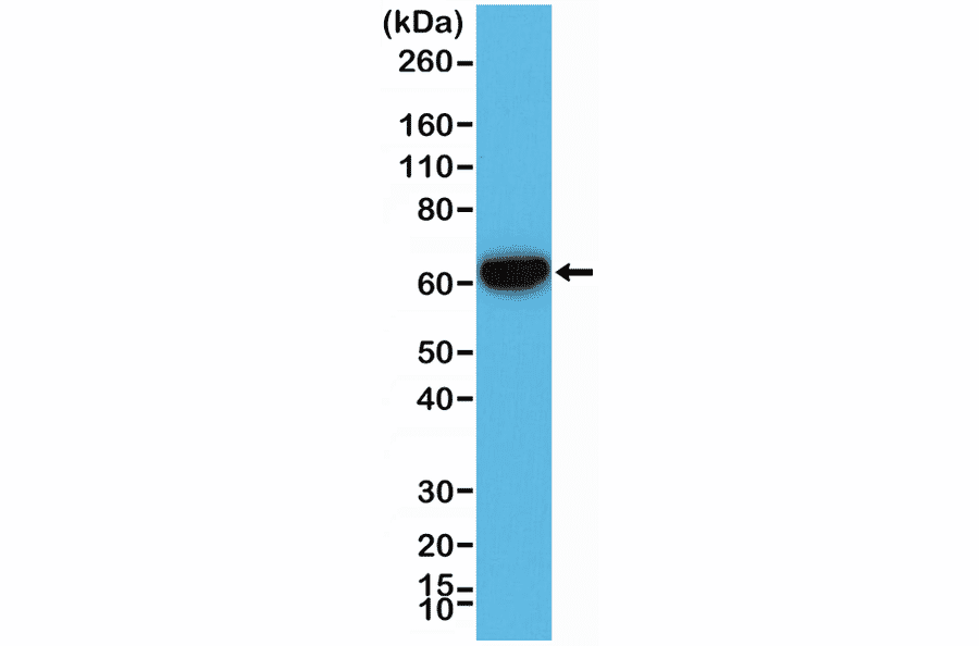 Western Blot - Anti-Cytokeratin 5 + 6 Antibody [RM341] (A121367) - Antibodies.com