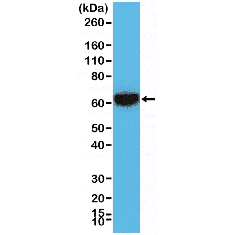 Western Blot - Anti-Cytokeratin 5 + 6 Antibody [RM341] (A121367) - Antibodies.com