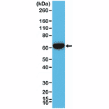 Western Blot - Anti-Cytokeratin 5 + 6 Antibody [RM341] (A121367) - Antibodies.com