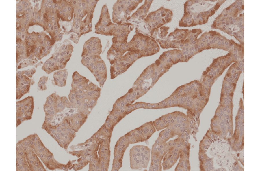 Immunohistochemistry - Anti-Prostate Specific Antigen Antibody [RM323] (A121220) - Antibodies.com