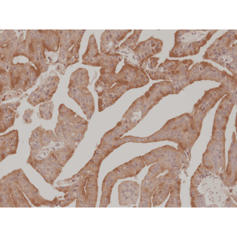 Immunohistochemistry - Anti-Prostate Specific Antigen Antibody [RM323] (A121220) - Antibodies.com