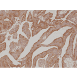 Immunohistochemistry - Anti-Prostate Specific Antigen Antibody [RM323] (A121220) - Antibodies.com