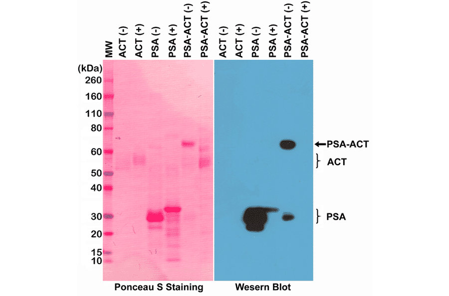 Western Blot - Anti-Prostate Specific Antigen Antibody [RM323] (A121368) - Antibodies.com