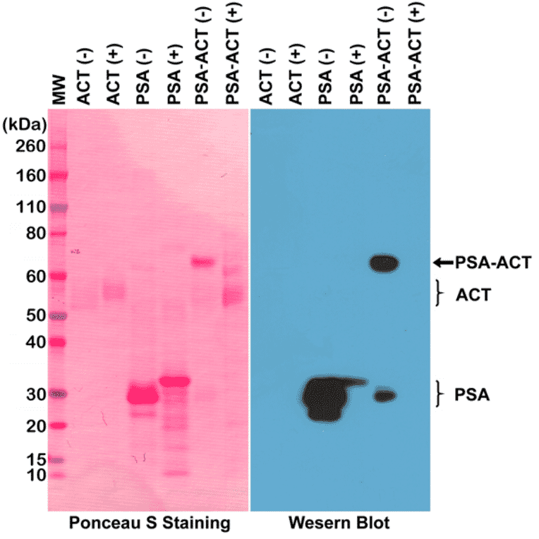 Western Blot - Anti-Prostate Specific Antigen Antibody [RM323] (A121368) - Antibodies.com