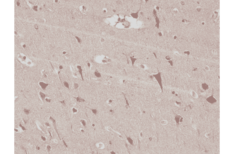 Immunohistochemistry - Anti-PSD95 Antibody [RM288] (A121503) - Antibodies.com