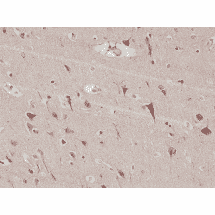 Immunohistochemistry - Anti-PSD95 Antibody [RM288] (A121503) - Antibodies.com