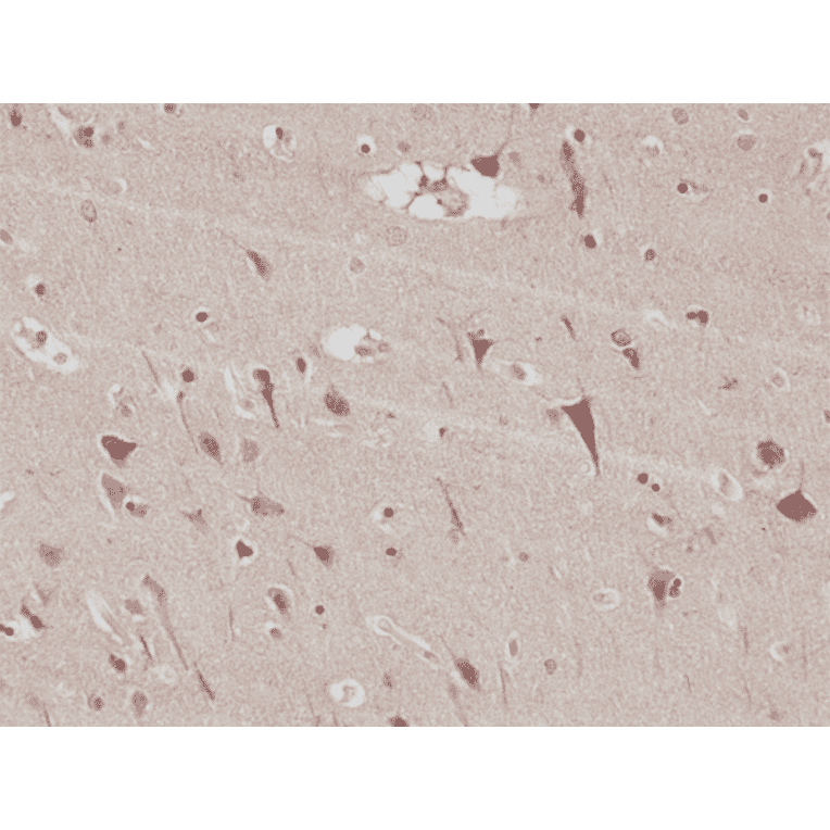 Immunohistochemistry - Anti-PSD95 Antibody [RM288] (A121503) - Antibodies.com
