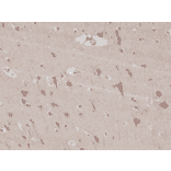 Immunohistochemistry - Anti-PSD95 Antibody [RM288] (A121503) - Antibodies.com