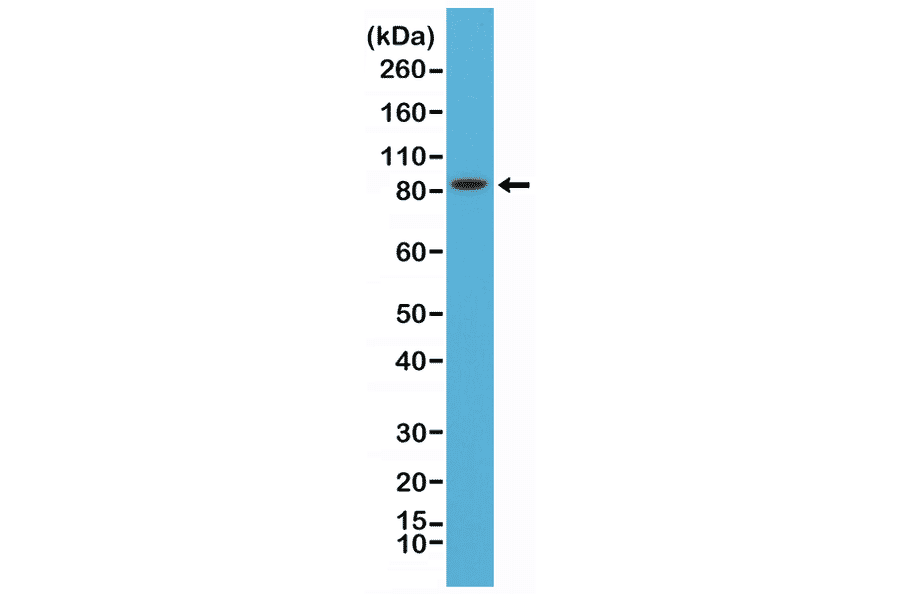 Western Blot - Anti-PSD95 Antibody [RM288] (A121369) - Antibodies.com