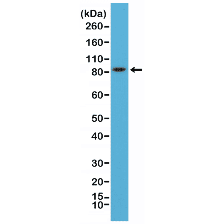 Western Blot - Anti-PSD95 Antibody [RM288] (A121369) - Antibodies.com