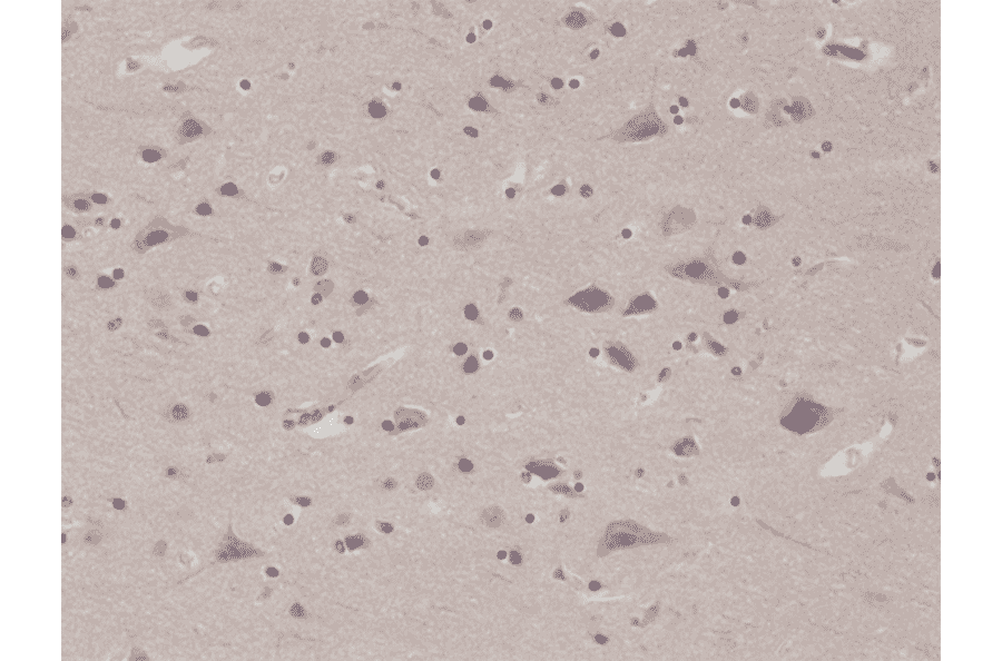 Immunohistochemistry - Anti-PTEN Antibody [RM265] (A121408) - Antibodies.com