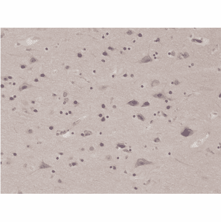 Immunohistochemistry - Anti-PTEN Antibody [RM265] (A121408) - Antibodies.com