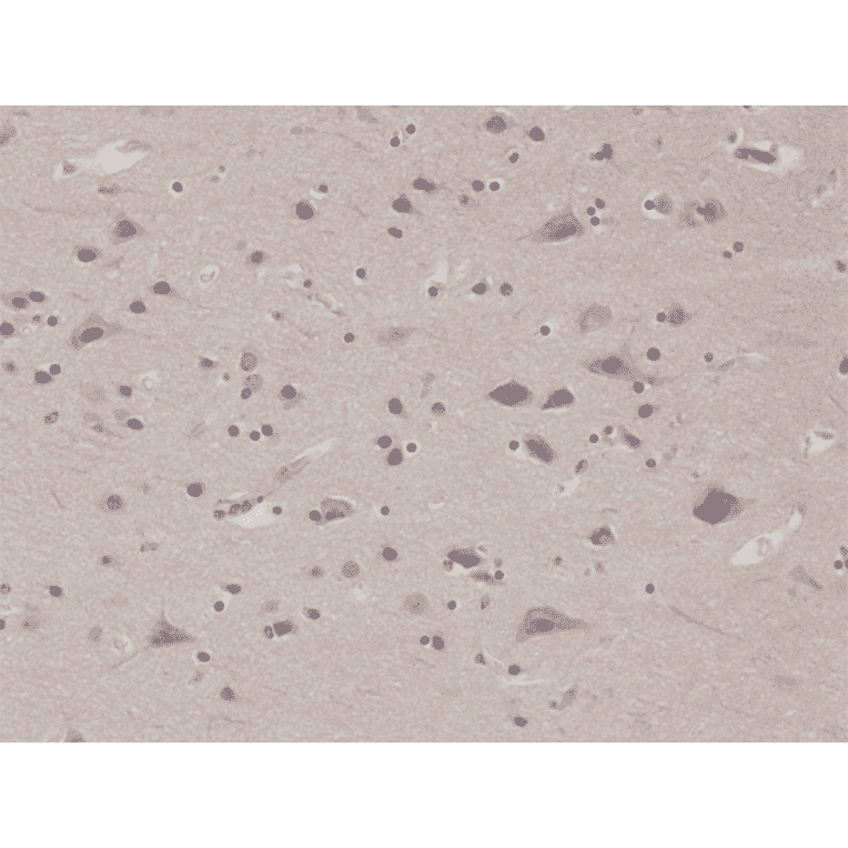 Immunohistochemistry - Anti-PTEN Antibody [RM265] (A121408) - Antibodies.com