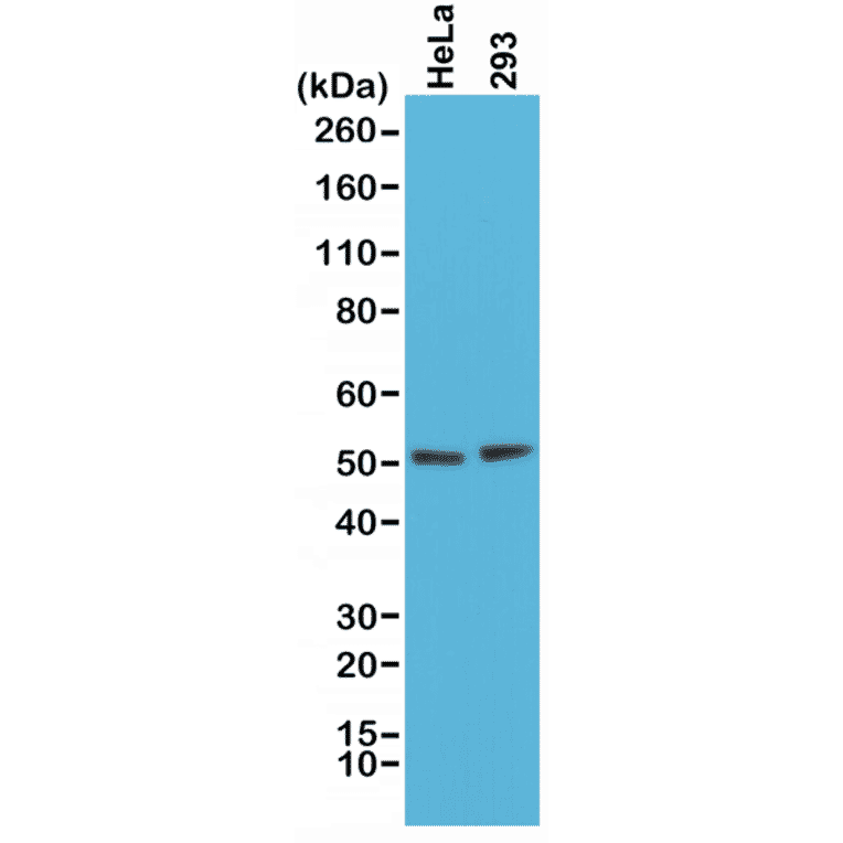 Western Blot - Anti-PTEN Antibody [RM265] (A121370) - Antibodies.com
