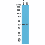 Western Blot - Anti-PTEN Antibody [RM265] (A121370) - Antibodies.com