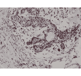 Immunohistochemistry - Anti-p27 KIP 1 Antibody [RM302] (A121501) - Antibodies.com