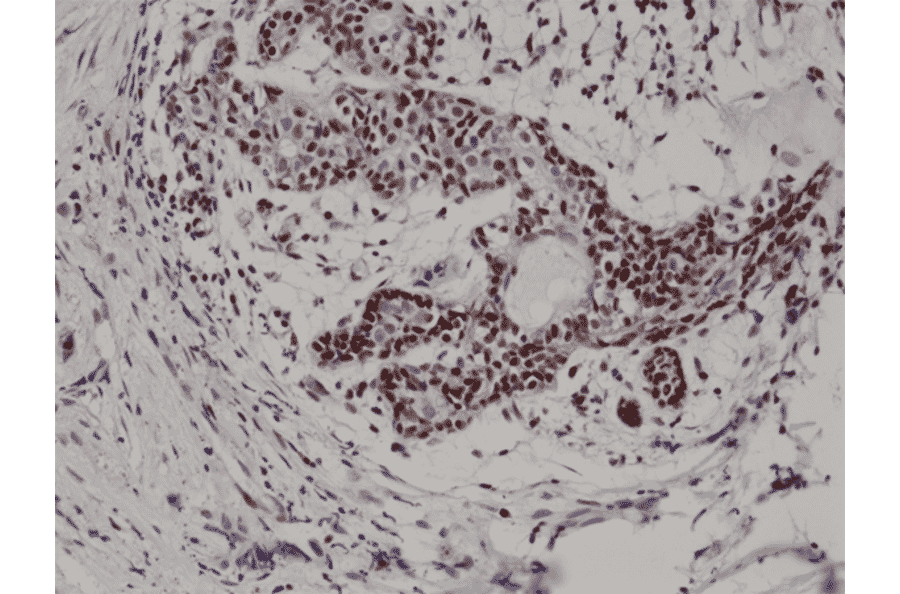 Immunohistochemistry - Anti-p27 KIP 1 Antibody [RM302] (A121501) - Antibodies.com