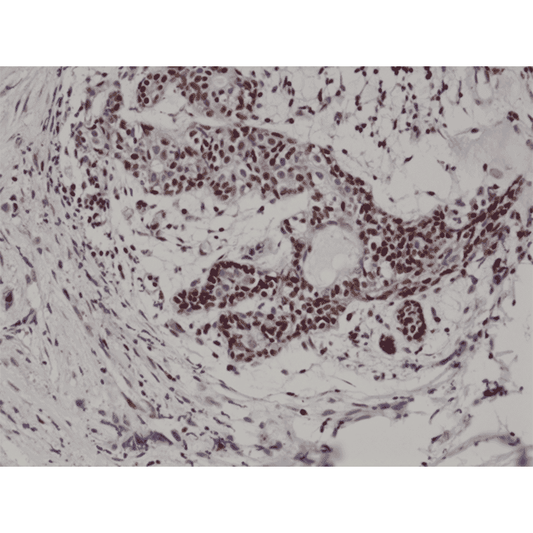 Immunohistochemistry - Anti-p27 KIP 1 Antibody [RM302] (A121501) - Antibodies.com