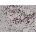 Immunohistochemistry - Anti-p27 KIP 1 Antibody [RM302] (A121501) - Antibodies.com
