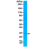 Western Blot - Anti-p27 KIP 1 Antibody [RM302] (A121371) - Antibodies.com
