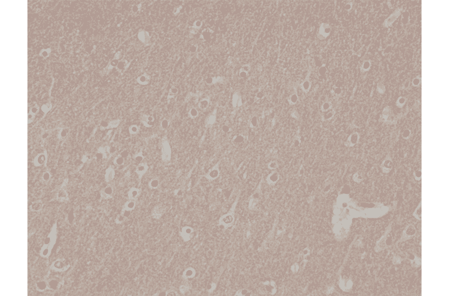 Immunohistochemistry - Anti-CD56 Antibody [RM315] (A121481) - Antibodies.com