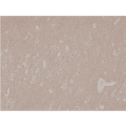 Immunohistochemistry - Anti-CD56 Antibody [RM315] (A121481) - Antibodies.com