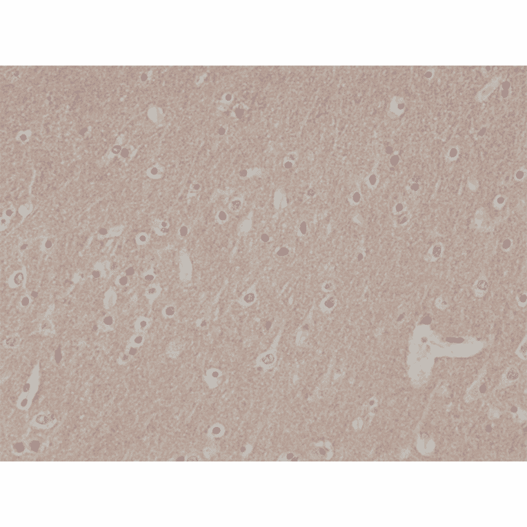 Immunohistochemistry - Anti-CD56 Antibody [RM315] (A121481) - Antibodies.com