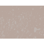 Immunohistochemistry - Anti-CD56 Antibody [RM315] (A121481) - Antibodies.com