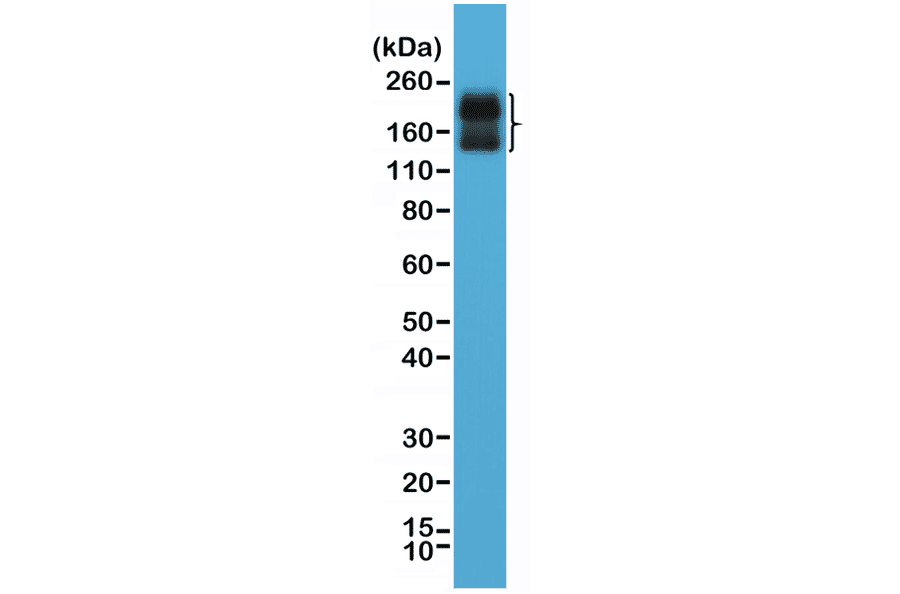 Western Blot - Anti-CD56 Antibody [RM315] (A121372) - Antibodies.com