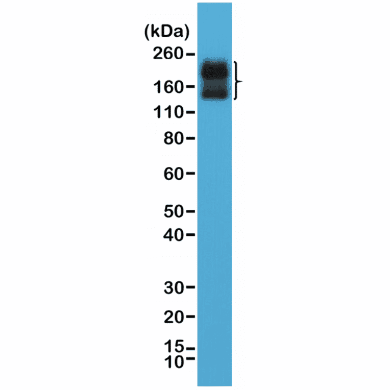 Western Blot - Anti-CD56 Antibody [RM315] (A121372) - Antibodies.com