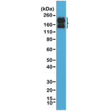 Western Blot - Anti-CD56 Antibody [RM315] (A121372) - Antibodies.com