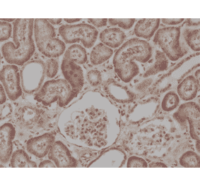 Immunohistochemistry - Anti-BRAF Antibody [RM308] (A121293) - Antibodies.com