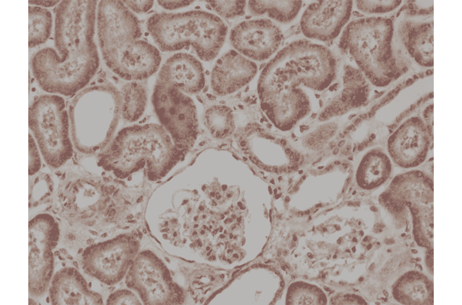 Immunohistochemistry - Anti-BRAF Antibody [RM308] (A121293) - Antibodies.com