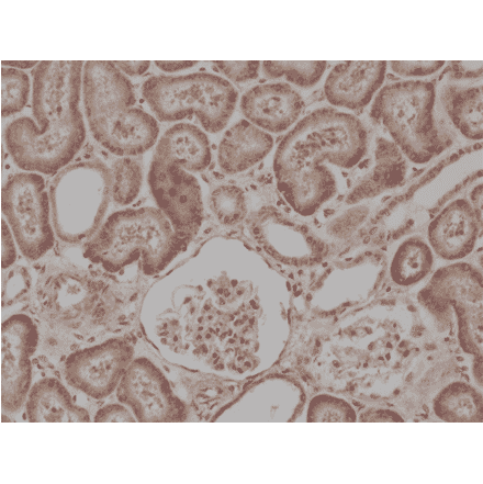 Immunohistochemistry - Anti-BRAF Antibody [RM308] (A121293) - Antibodies.com
