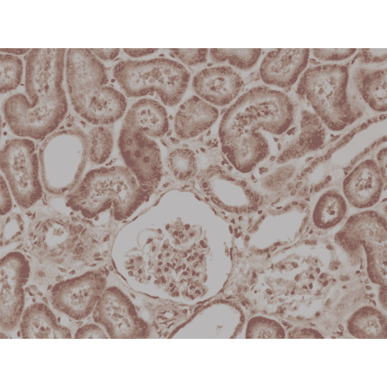 Immunohistochemistry - Anti-BRAF Antibody [RM308] (A121293) - Antibodies.com