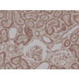 Immunohistochemistry - Anti-BRAF Antibody [RM308] (A121293) - Antibodies.com