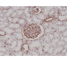 Immunohistochemistry - Anti-Vimentin Antibody [RM289] (A121369) - Antibodies.com